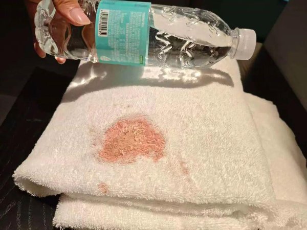 港陆证券 男子发现酒店浴巾有大片血迹，担心染病要求赔偿！酒店质疑：血迹非常新鲜，网友热议